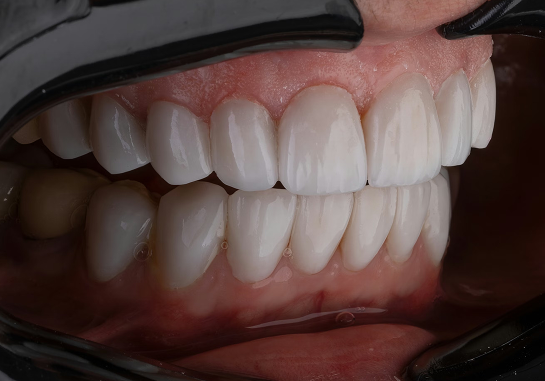 Post Title Lorem ipsum dolor sit amet. 2